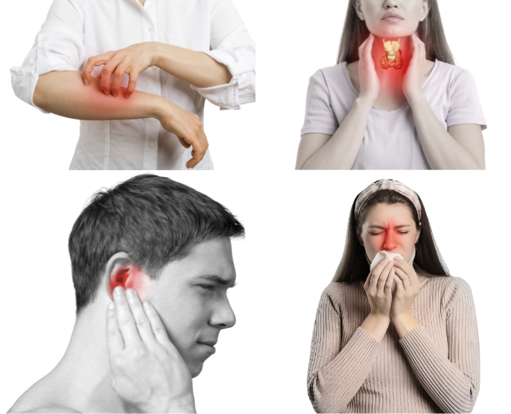 Allergy Treatment