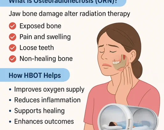 Hyperbaric Oxygen Therapy (HBOT) for Osteoradionecrosis – KiMi Health Hub Jaipur Medical infographic on Hyperbaric Oxygen Therapy (HBOT) for Osteoradionecrosis of the jaw, showing symptoms like exposed bone, pain, swelling, and loose teeth, with a patient receiving treatment in a mono-place HBOT chamber.