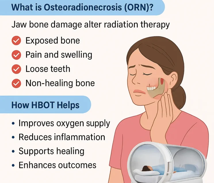 Medical infographic on Hyperbaric Oxygen Therapy (HBOT) for Osteoradionecrosis of the jaw, showing symptoms like exposed bone, pain, swelling, and loose teeth, with a patient receiving treatment in a mono-place HBOT chamber.