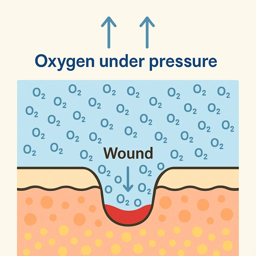 oxygen under pressure reaching a wound